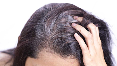 Hair loss/grey hair repair center prevention
